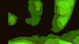 Vintage Lesbian Lovers Embrace Passionately