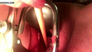 How is that cervix getting stretched and sounded?