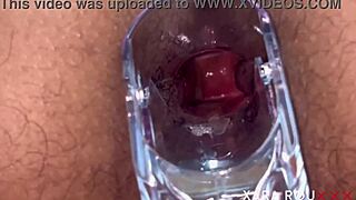 huge ass gaping with speculum in anal vision