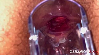 huge ass gaping with speculum in anal vision