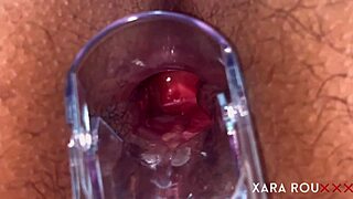 huge ass gaping with speculum in anal vision