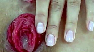 Destroyed anal with juicy prolapse asshole in extreme close up play!