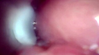 Endoscope Captures Semen Flooding Wide-Stretched Dripping Pussy