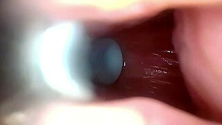 Endoscope Captures Semen Flooding Wide-Stretched Dripping Pussy
